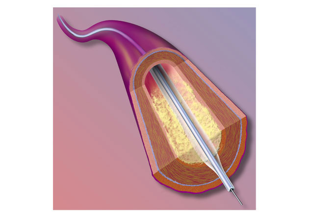 Christine Prapas represents: Steve Ellis, medical illustrator